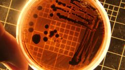Meal Delivery Service Recall: Salmonella Outbreak Sickens 16, CDC Warns