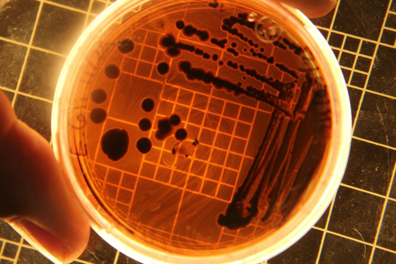 Meal Delivery Service Recall: Salmonella Outbreak Sickens 16, CDC Warns